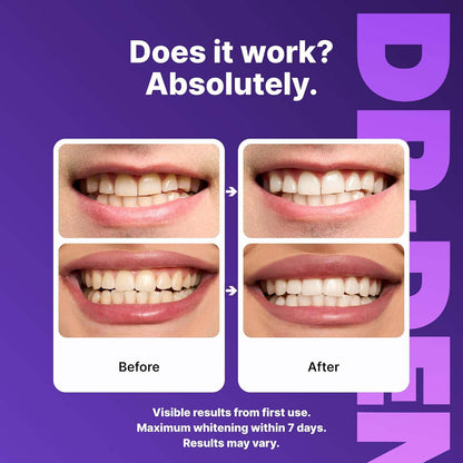 DR-DENT® WHITENING STRIPS